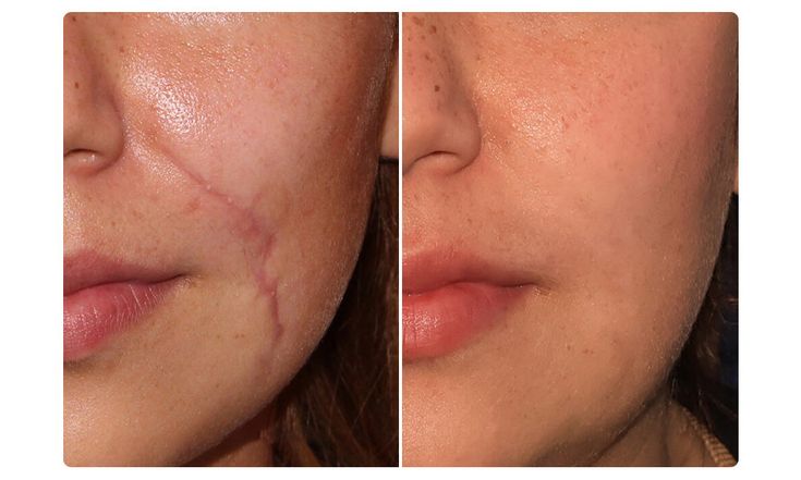 120ddadb61873725dff43dd0547167e0