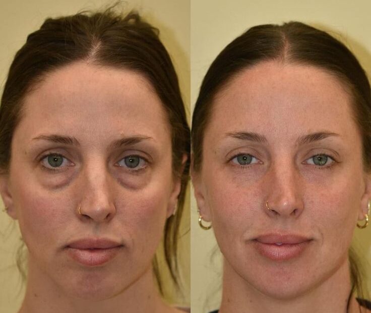 93bccb6533dd59e78ea4438d63ddd853