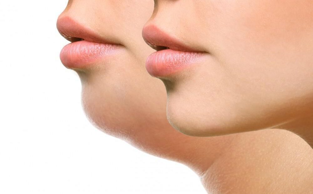 941608f5bd637e37809ded77817938b7