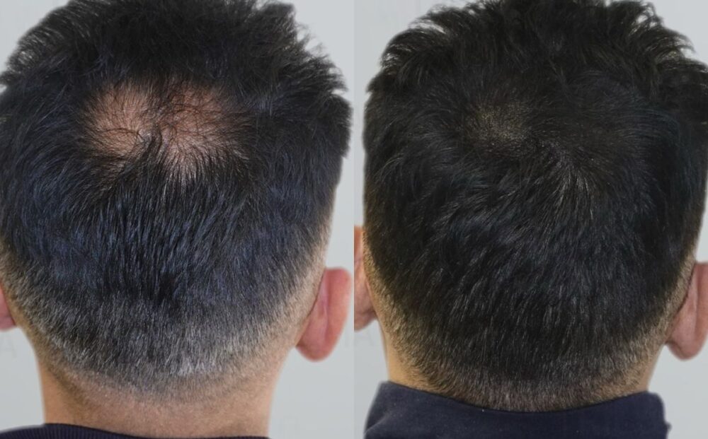 af12c01d2a2aa6c5e963f5f62077036c